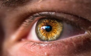 Eye Conditions And The Role Of Inheritance